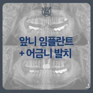 영선동치과추천