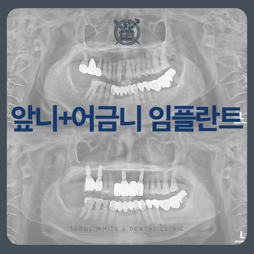 영도구치과잘하는곳