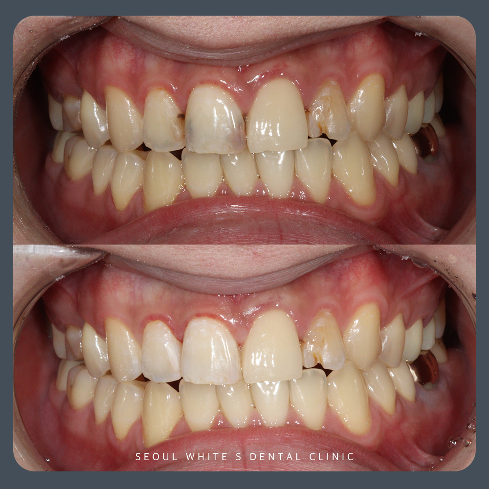 영도구치과추천