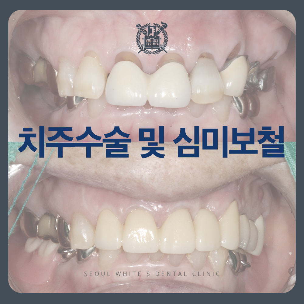 남항동심미보철