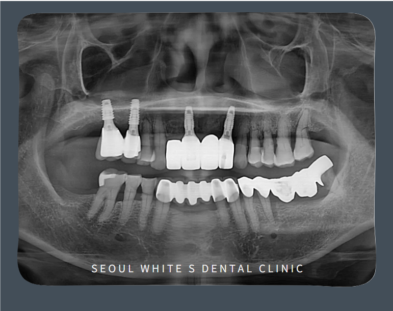 영도구치과잘하는곳