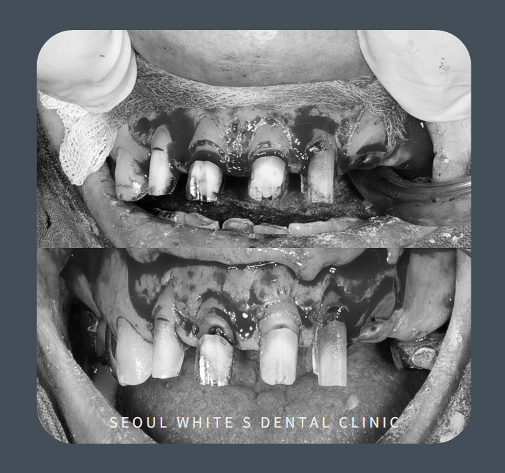 남항동심미보철