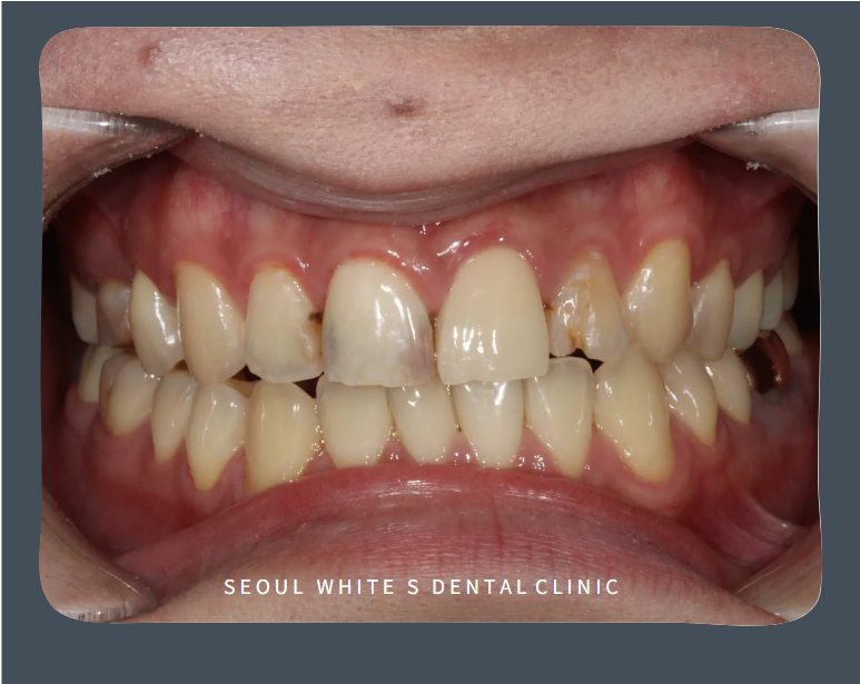 영도구치과추천