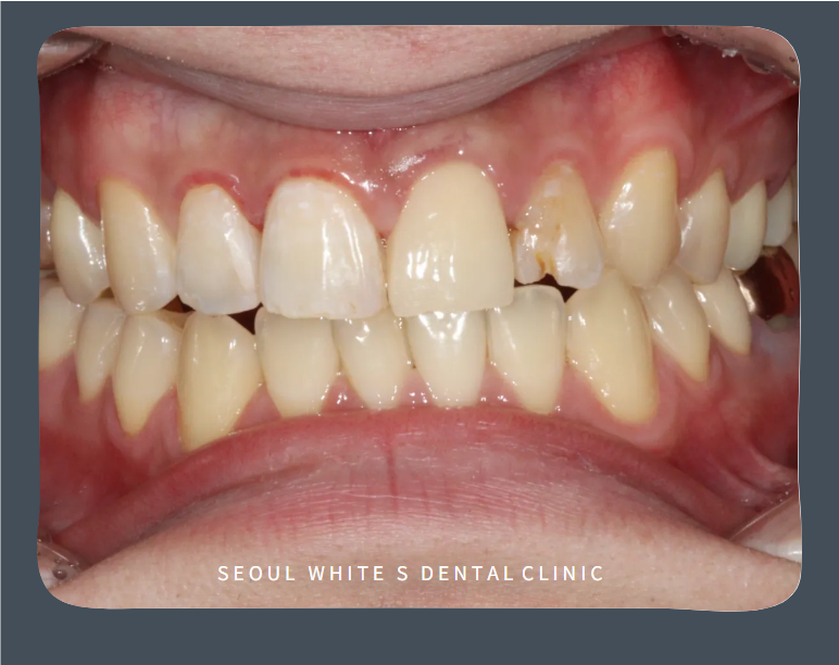 영도구치과추천