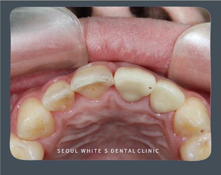 영도구치과추천