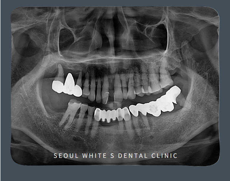 영도구치과잘하는곳