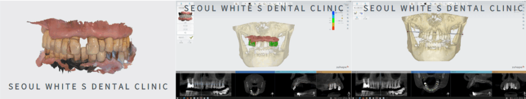 영도구치과잘하는곳