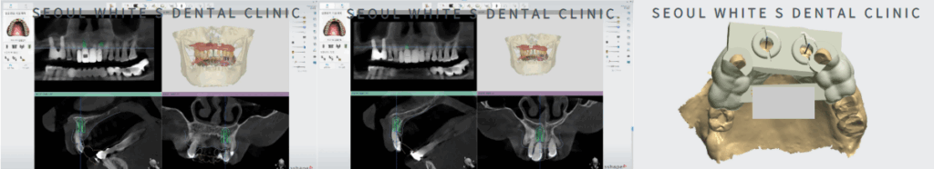 영도구치과잘하는곳
