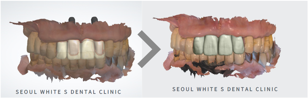 영도구치과잘하는곳