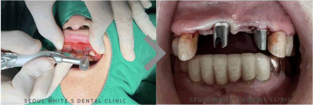 영도구치과잘하는곳
