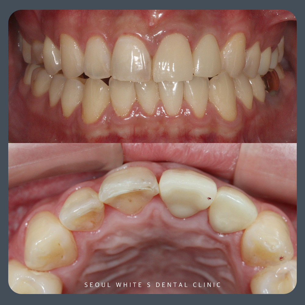 영도구치과추천