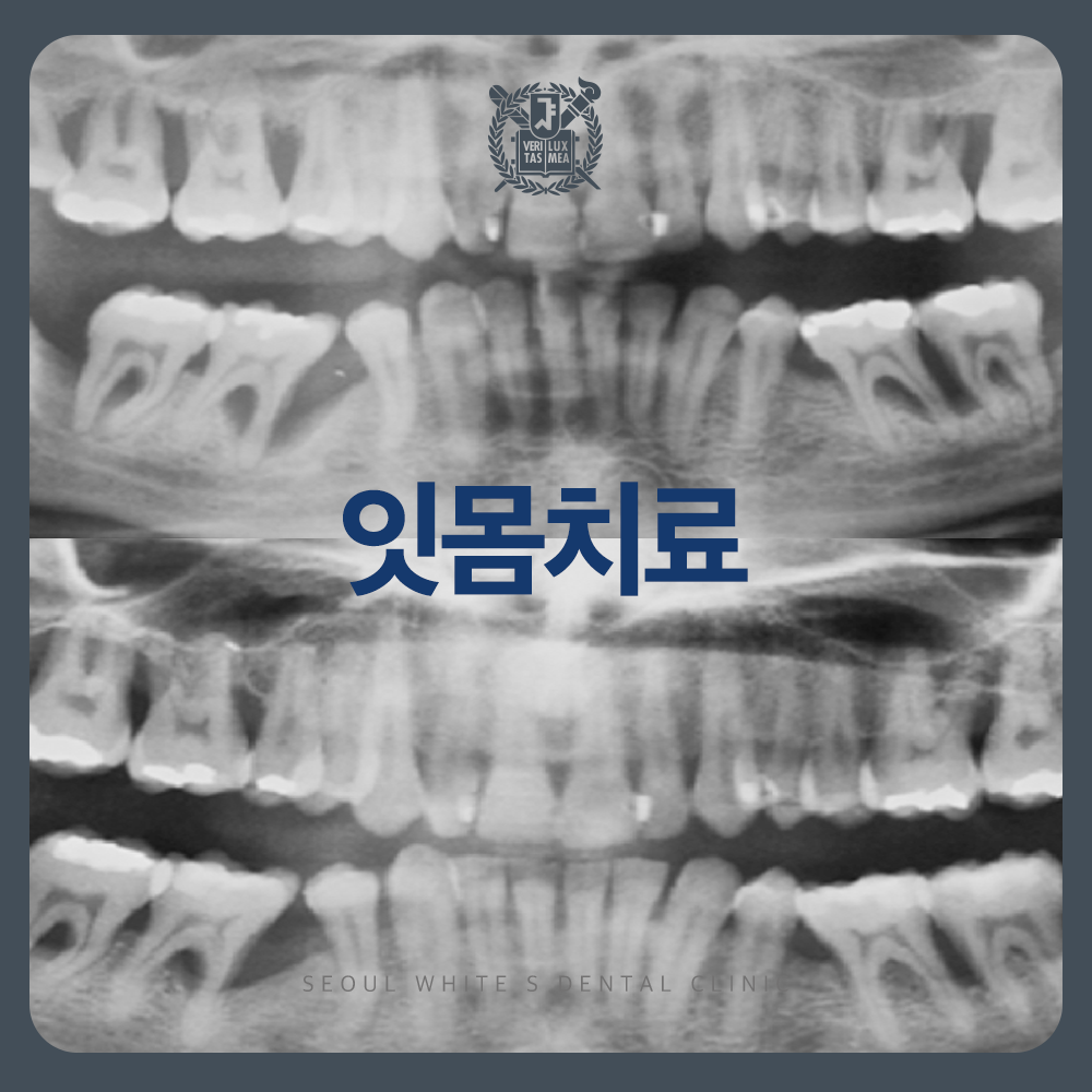 영선동잇몸치료