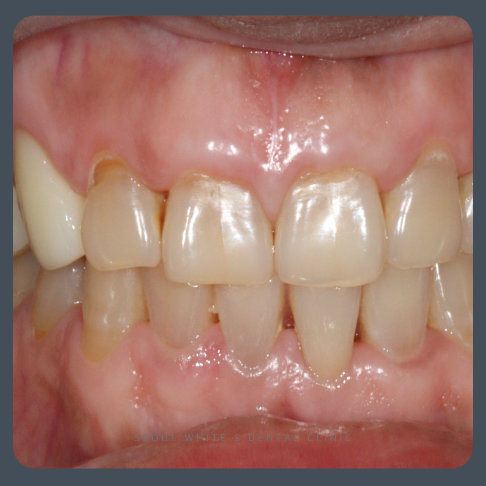 영선동잇몸치료