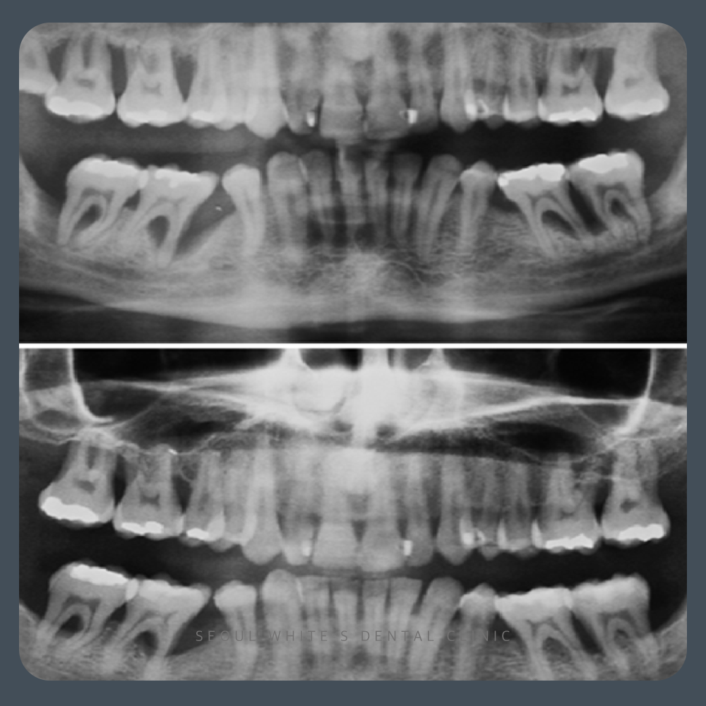 영선동잇몸치료