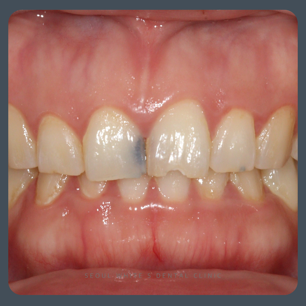 부산영도구치과