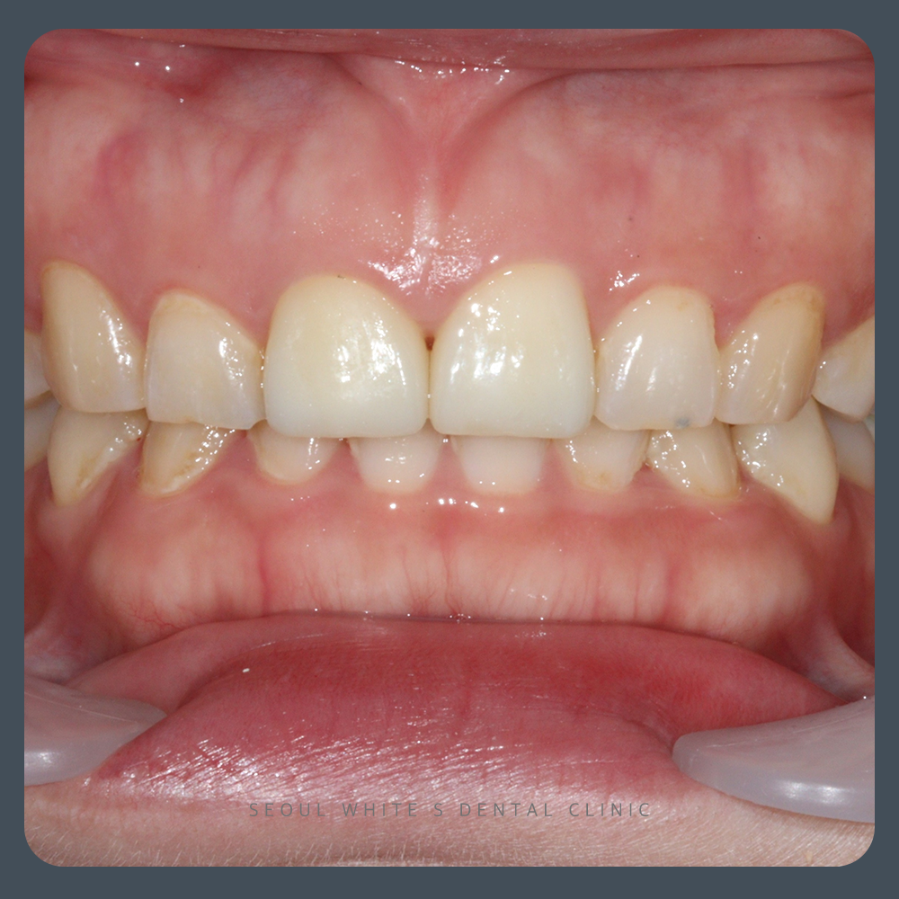 부산영도구치과