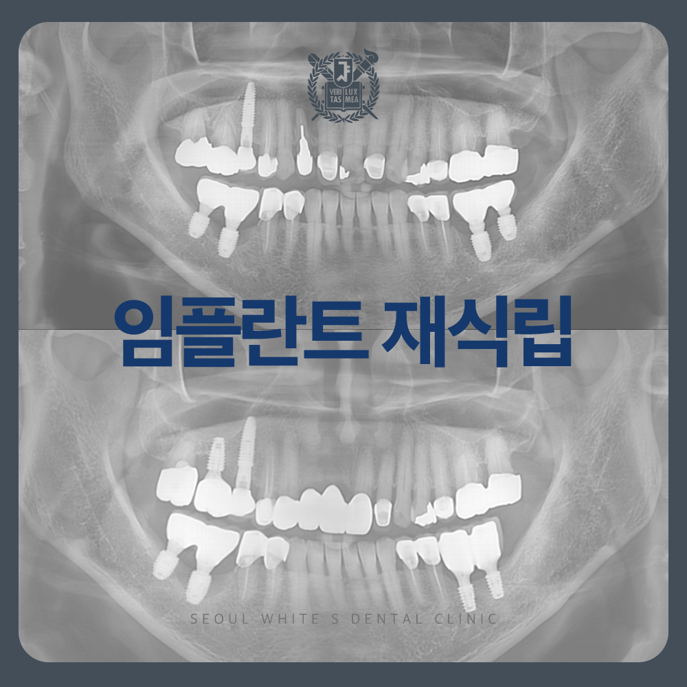 영도구임플란트