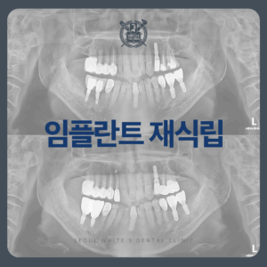 영도임플란트