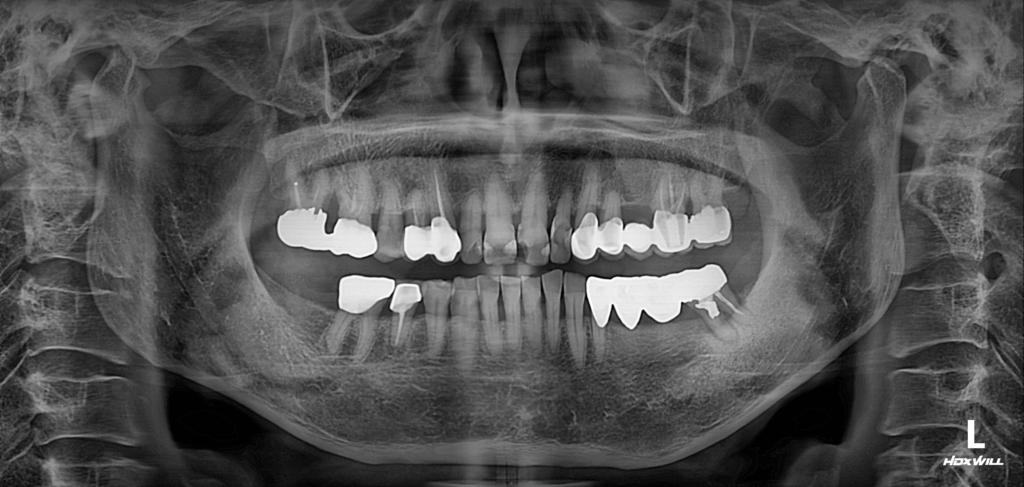남포동임플란트