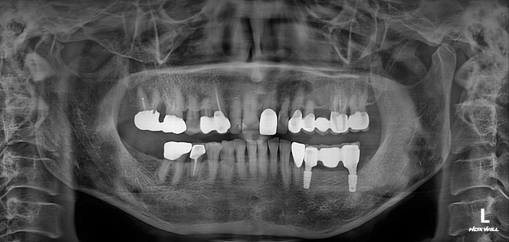 남포동임플란트