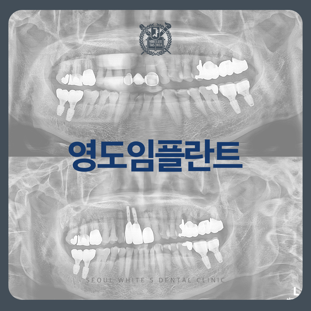 영도임플란트