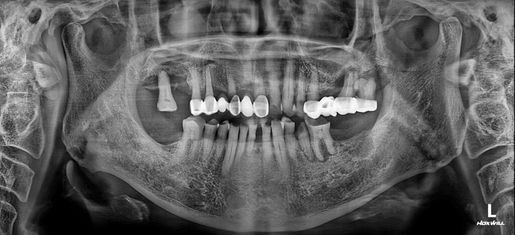 남포동임플란트