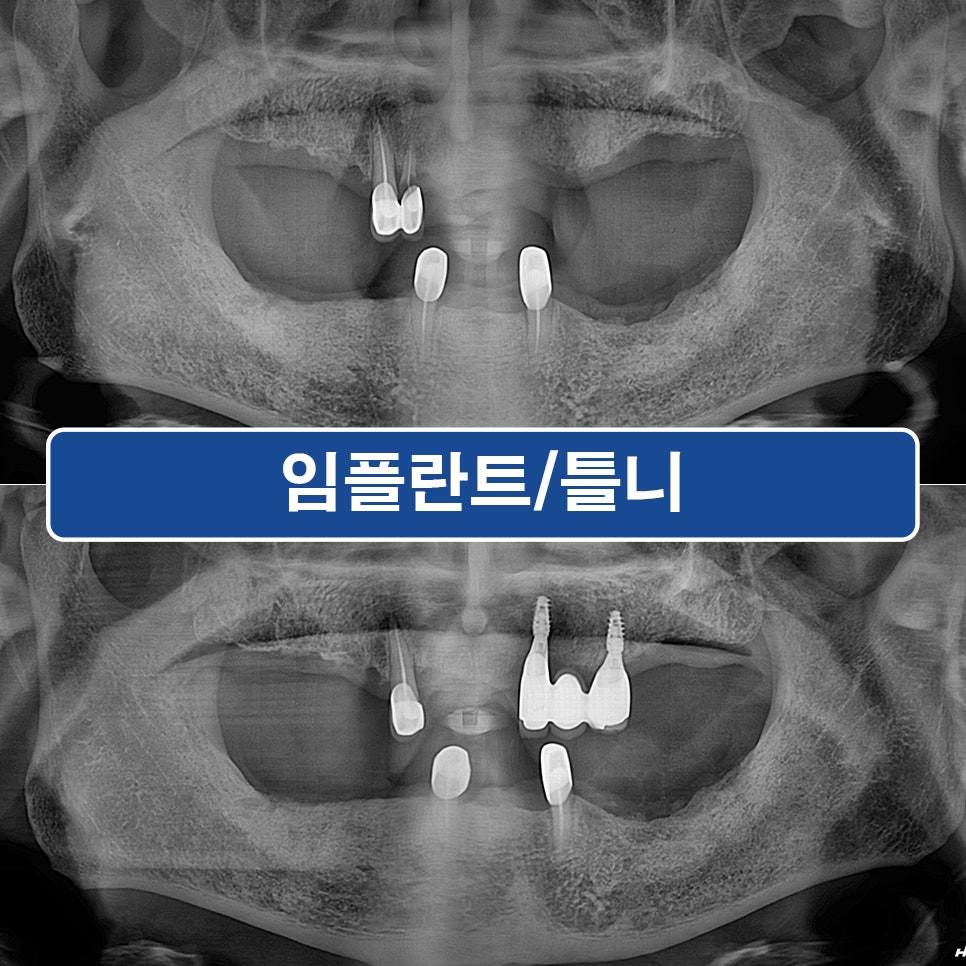기장치과틀니잘하는곳